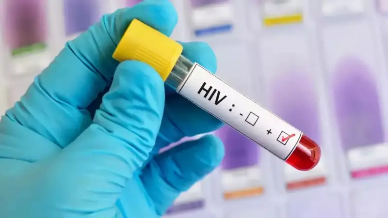 HIV: Η μεγαλύτερη πτώση της ιστορίας του ήταν πέρυσι